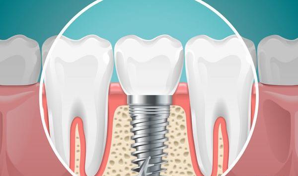 عکس وسایل دندانپزشکی برای پروفایل
