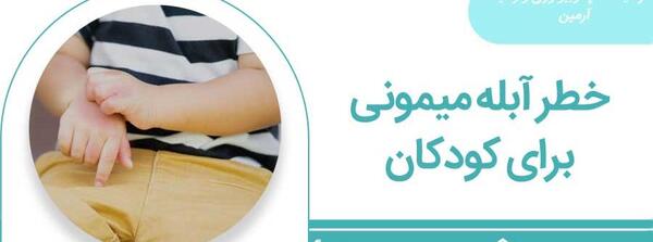 عکس آبله میمونی در کودکان