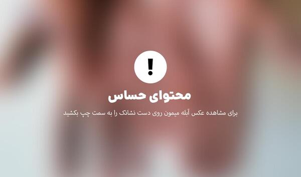 عکس آبله میمونی در ایران