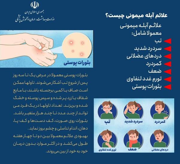 عکس آبله میمونی در ایران