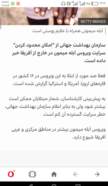 عکس آبله میمون در کودکان نی نی سایت