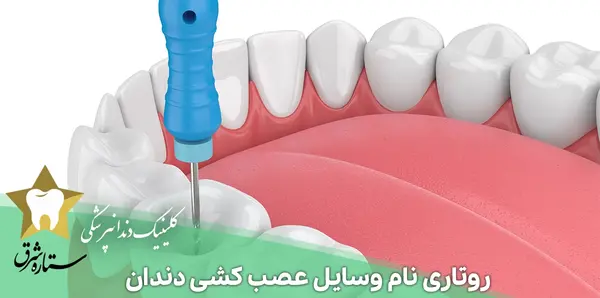 وسایل عصب کشی دندان با عکس