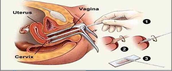 وسایل عکس رنگی از رحم