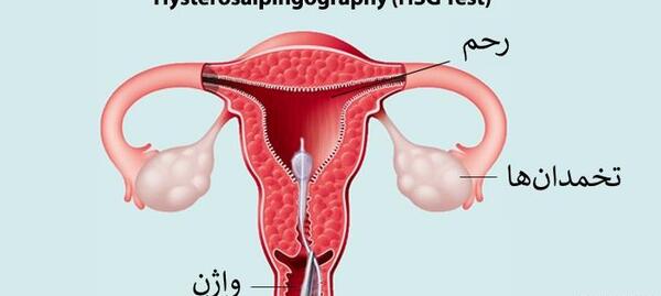 وسایل عکس رنگی از رحم