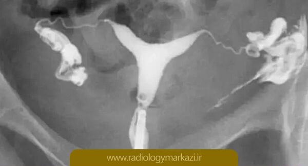 وسایل عکس رنگی از رحم