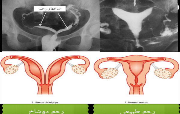 وسایل عکس رنگی از رحم