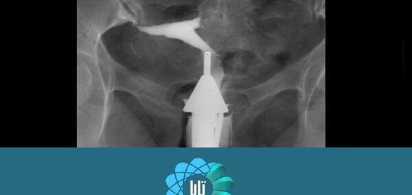 وسایل عکس رنگی از رحم