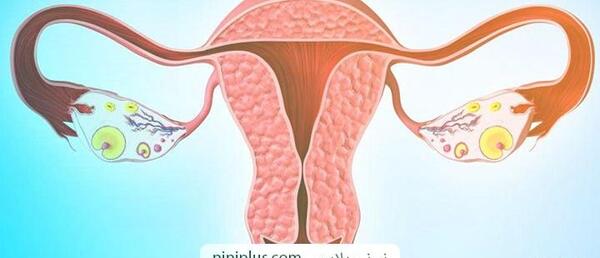 وسایل عکس رنگی از رحم