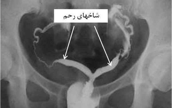 وسایل عکس رنگی از رحم