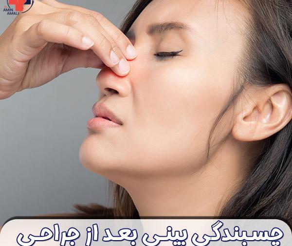 عکس داخل بینی بعد از عمل