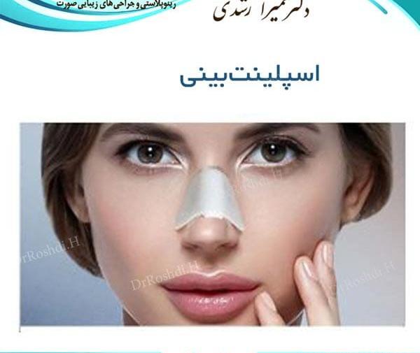 عکس داخل بینی عمل شده