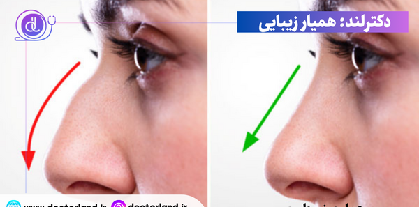 عکس داخل بینی عمل شده