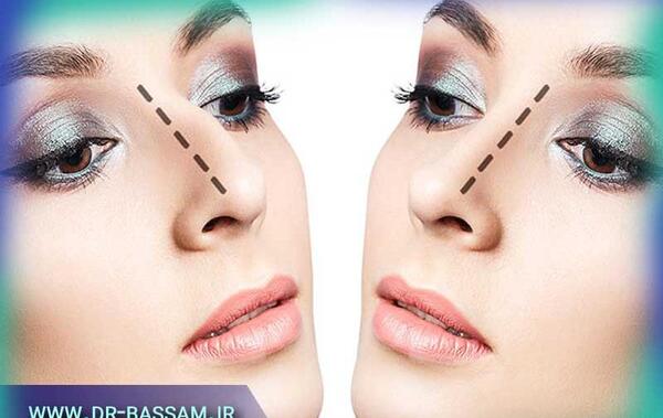 عکس داخل بینی طبیعی