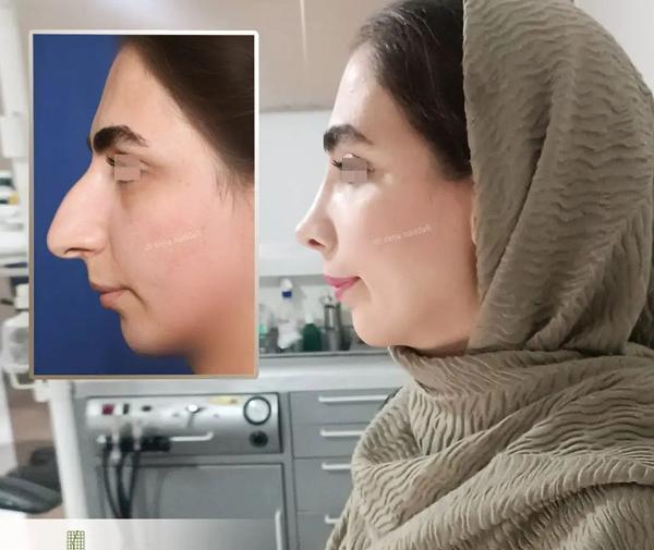 عکس داخل بینی طبیعی