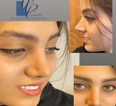 عکس داخل بینی طبیعی