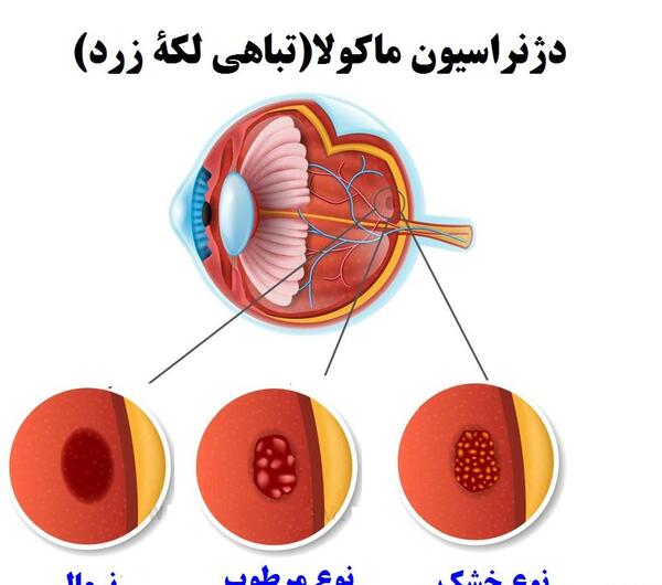 عکس داخل چشم کلاس پنجم