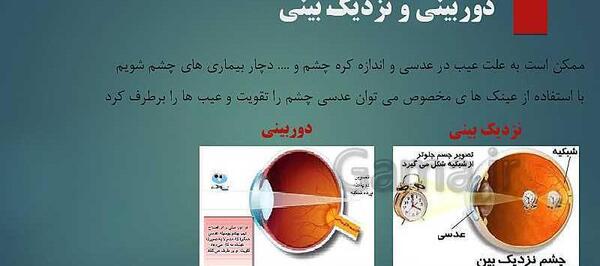 عکس داخل چشم کلاس پنجم