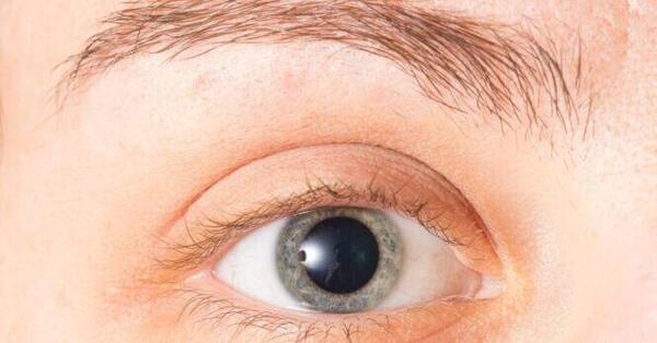 عکس داخل چشم کلاس پنجم