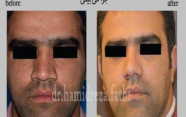 عکس داخل دماغ آدم