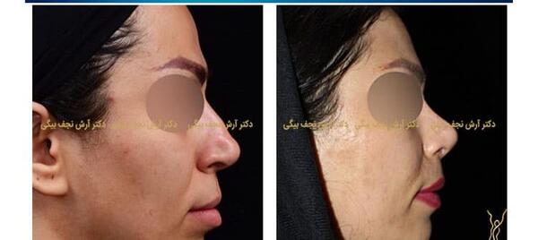 عکس داخل دماغ آدم