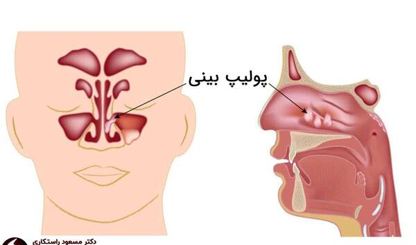 عکس داخل دماغ آدم