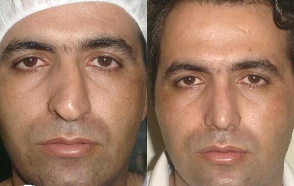 عکس داخل دماغ آدم