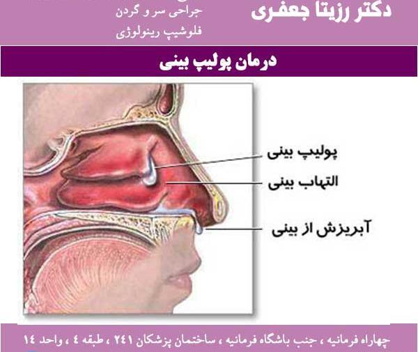 عکس داخل دماغ کودک