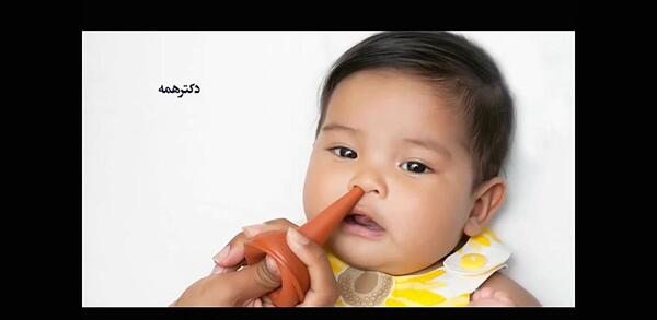 عکس داخل دماغ کودک