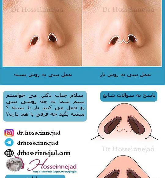 عکس داخل دماغ انسان
