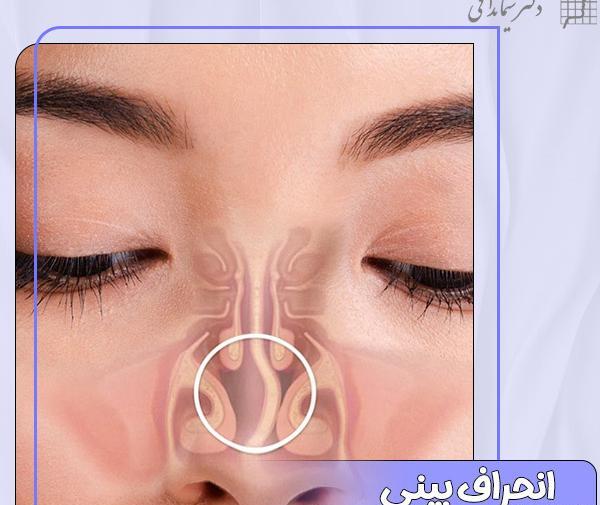 عکس داخل دماغ انسان