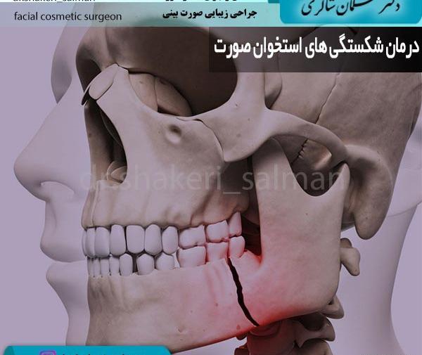 عکس داخل دماغ انسان