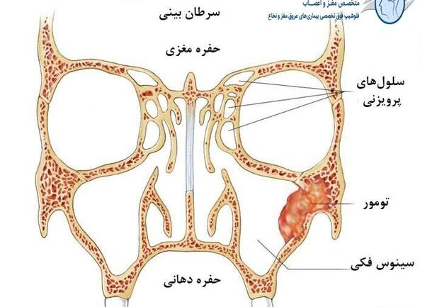 عکس داخل دماغ انسان
