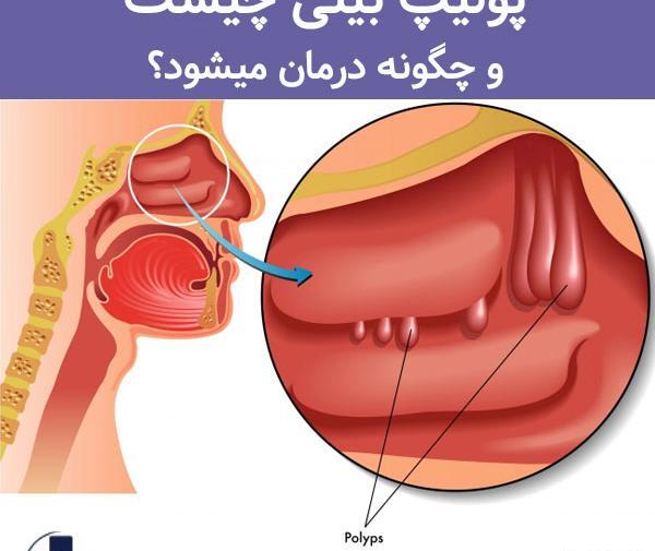 عکس داخل دماغ انسان