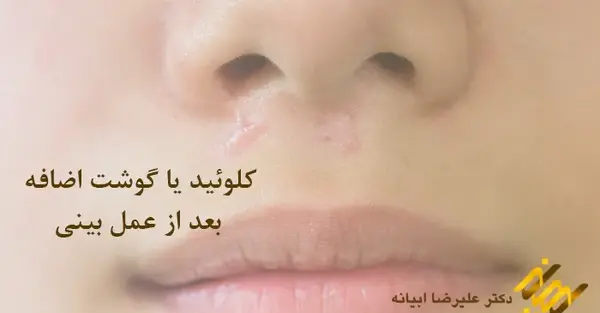 عکس داخل دماغ انسان