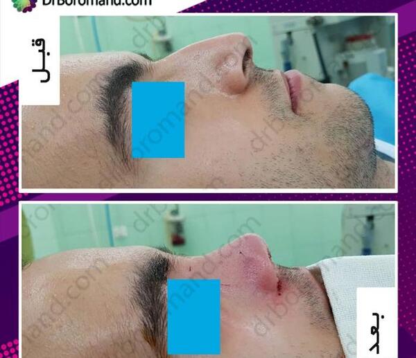 عکس از داخل دماغ