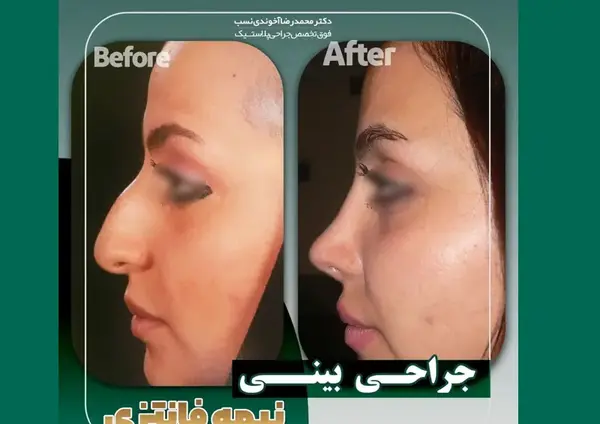 عکس از داخل دماغ