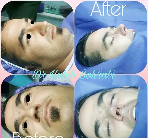 عکس از داخل دماغ