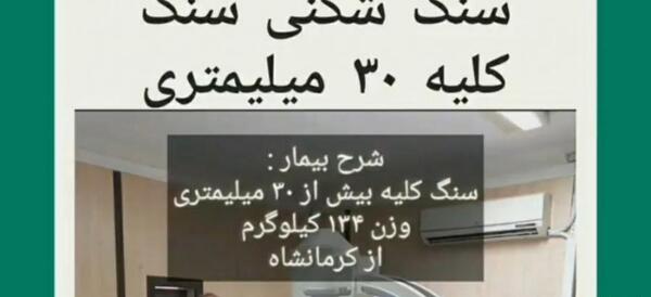عکس سنگ کلیه ۲۵ میلیمتری