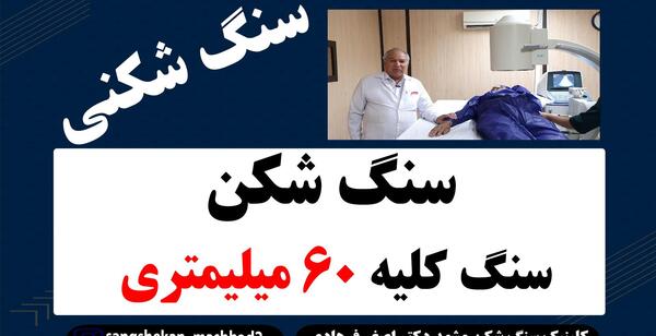 عکس سنگ کلیه ۲۵ میلیمتری