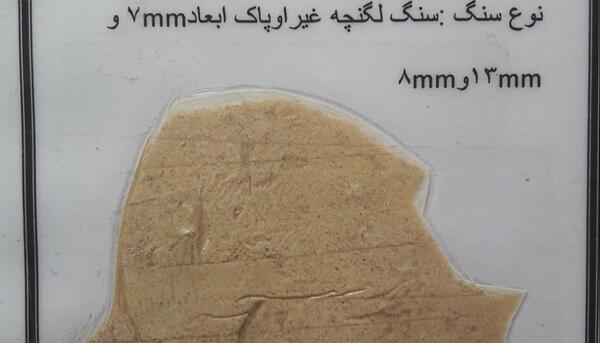 عکس سنگ کلیه خاردار
