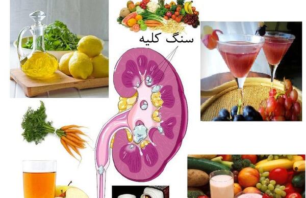 عکس سنگ کلیه خاردار