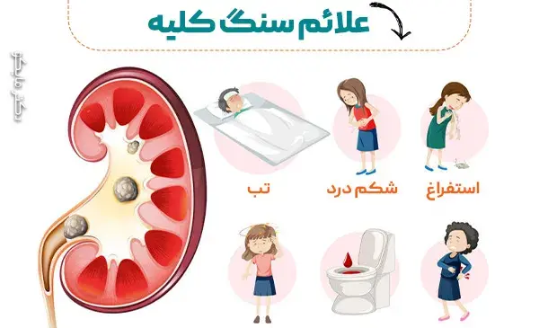 عکس سنگ کلیه خاردار
