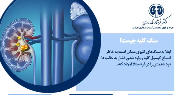 عکس سنگ کلیه ۵ میلیمتری