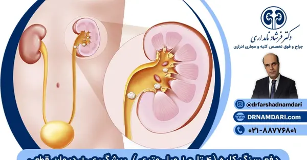 عکس سنگ کلیه 8 میلیمتری