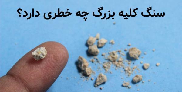 عکس سنگ کلیه 8 میلیمتری