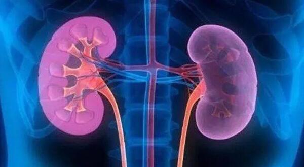 عکس بزرگترین سنگ کلیه جهان