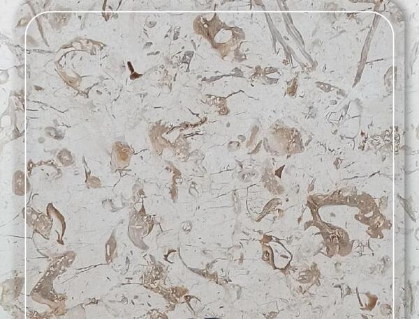 عکس سنگ پله پرطاووسی