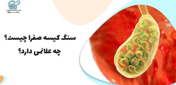 عکس کیسه صفرا پر از سنگ