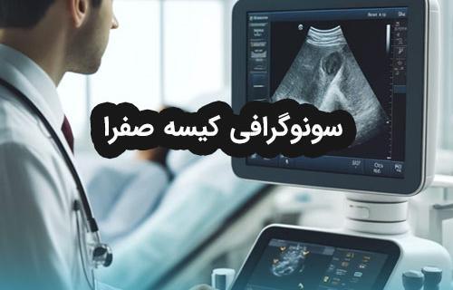 عکس سونوگرافی سنگ کیسه صفرا