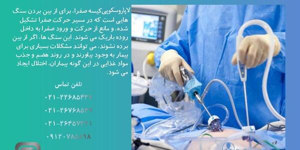 عکس عمل سنگ کیسه صفرا